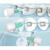 Dental Irregator Head WEW0984 2pcs White
