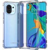 "Anti Shock Case Xiaomi Mi 11", skaidrus
