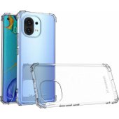 "Anti Shock Case Xiaomi Mi 11", skaidrus
